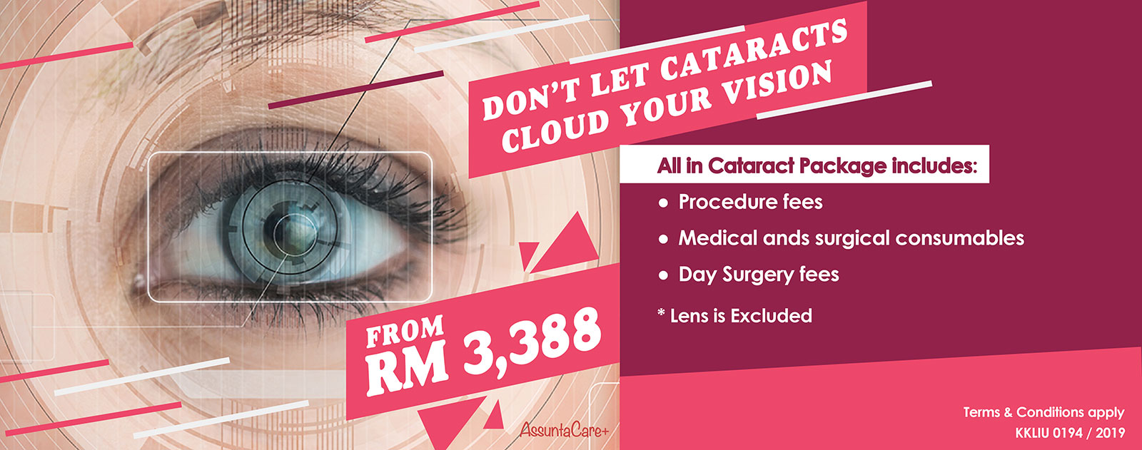 Cataract-sld-01